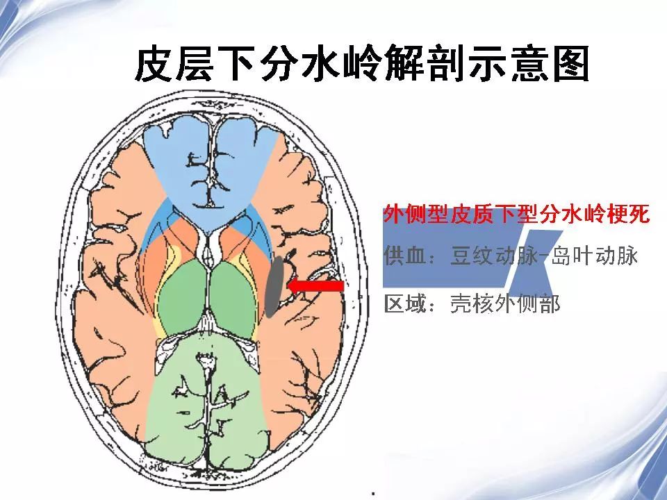 大脑分水岭区图片