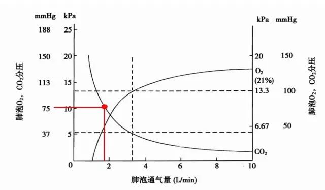 呼吸机压力太高 会把肺泡吹破吗?