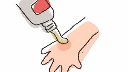 阴茎过短,就用雄激素类外用软膏,靠谱吗?