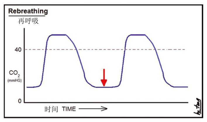 图4,换气过度的二氧化碳波形(图片来自mele tong.