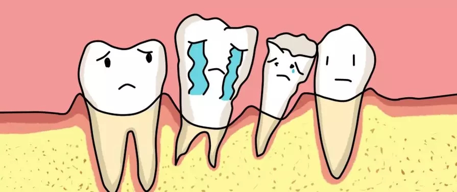 明明早晚都刷牙,为什么还会得牙周炎?