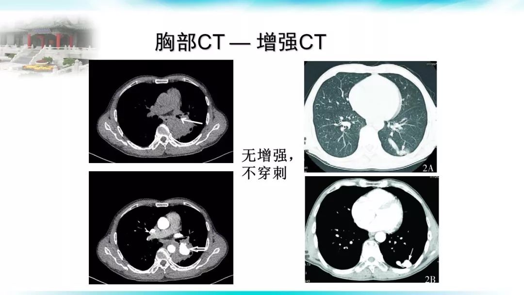 胸科麻醉實戰營胸部ct讀片要點與肺塌陷技術