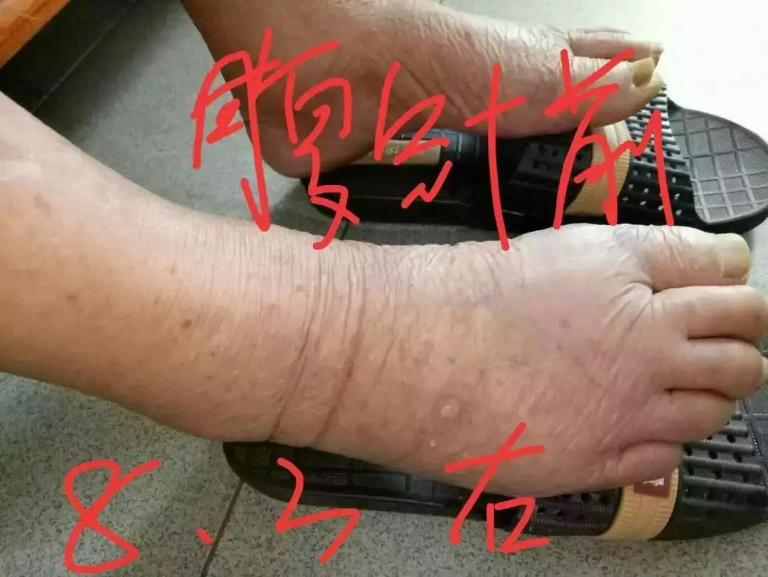 李松芝腹针:落藏,经络,八卦(治百病)