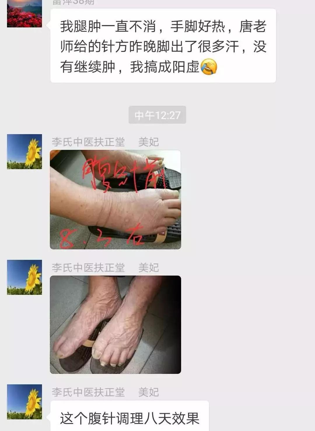 李松芝腹针:落藏,经络,八卦(治百病)