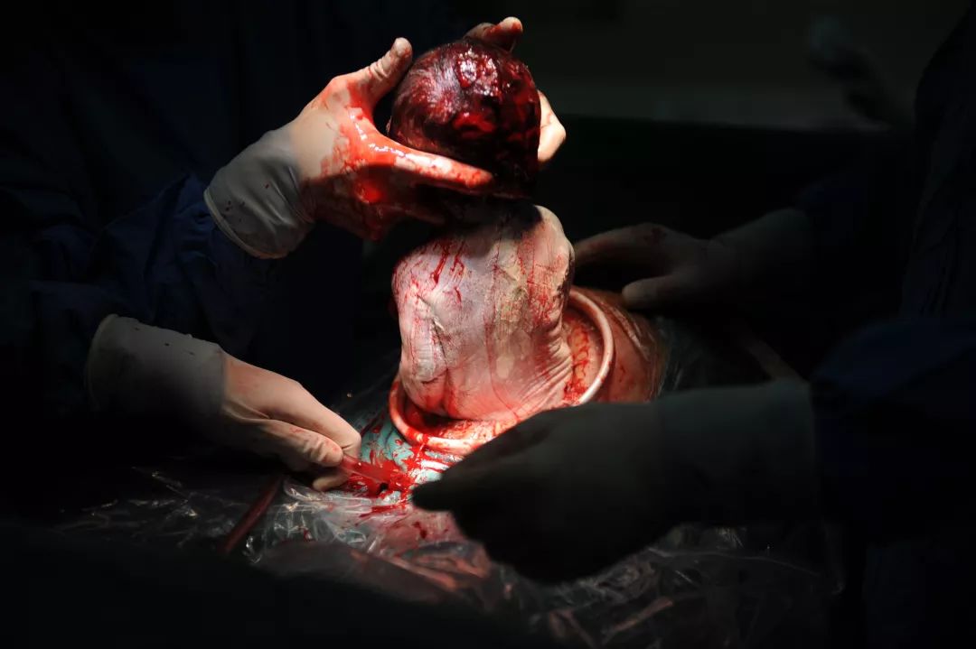 展示了医务人员守护在生命的初始阶段,本组照片通过剖腹产全程,而是