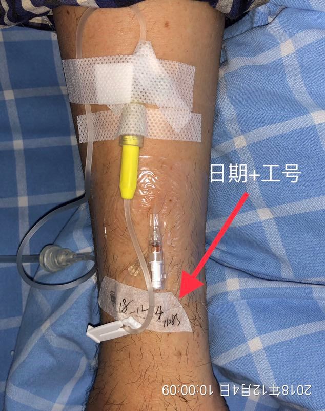 留置针固定的这个细节你确定做规范了吗