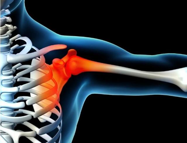 肩周炎是什么位置图片
