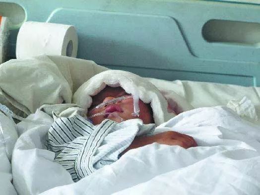 可是让人害怕的是,这么小的年纪,就进行了头部大手术,以后有没有并发