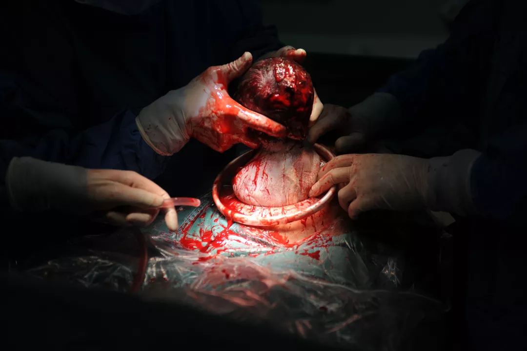 展示了医务人员守护在生命的初始阶段,本组照片通过剖腹产全程,而是