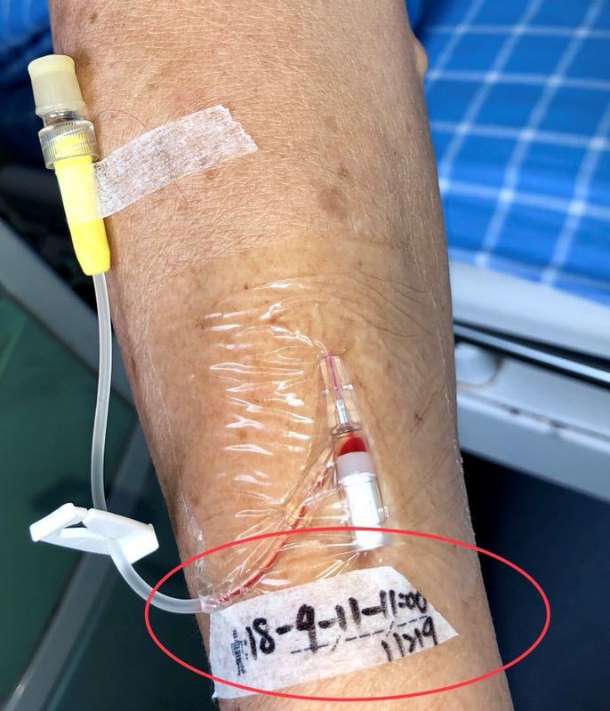 留置针固定的这个细节你确定做规范了吗
