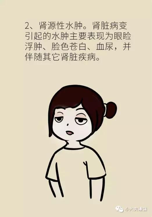 原来这才是日常各种水肿的真相_漫画