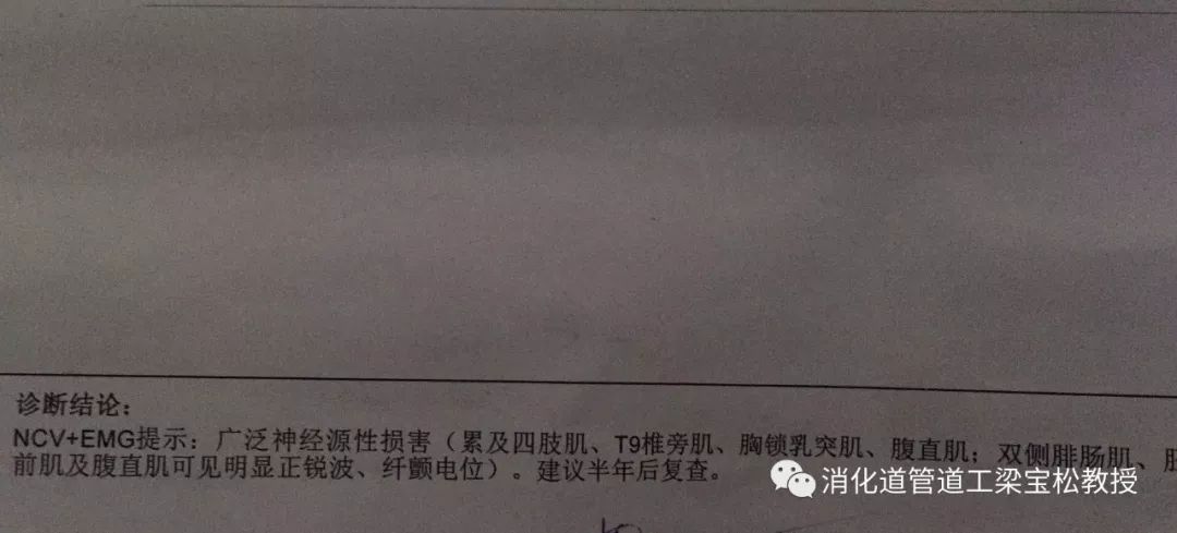 以下是患者第三次做的肌電圖河南省人民醫院神經電生理科 李六一歡迎