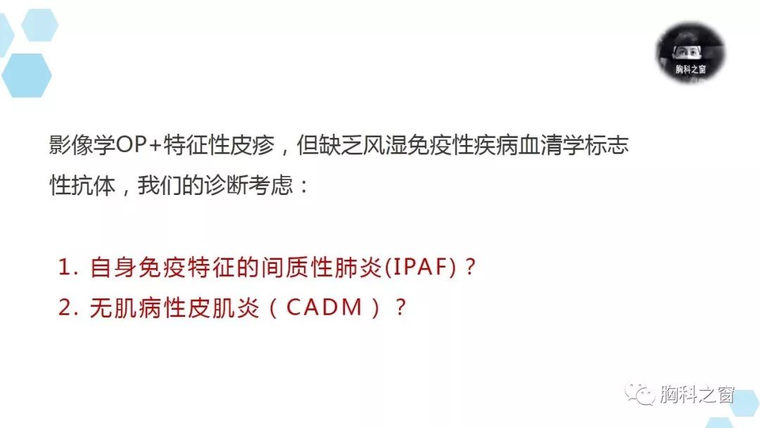 皮肌炎的自身抗体里,10-20%的肌炎患者可以检测到 mda5,而且mda5阳性