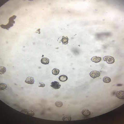 第二天早上来看育完卵的情况,虽然不是第一次在显微镜下看卵,但这是第