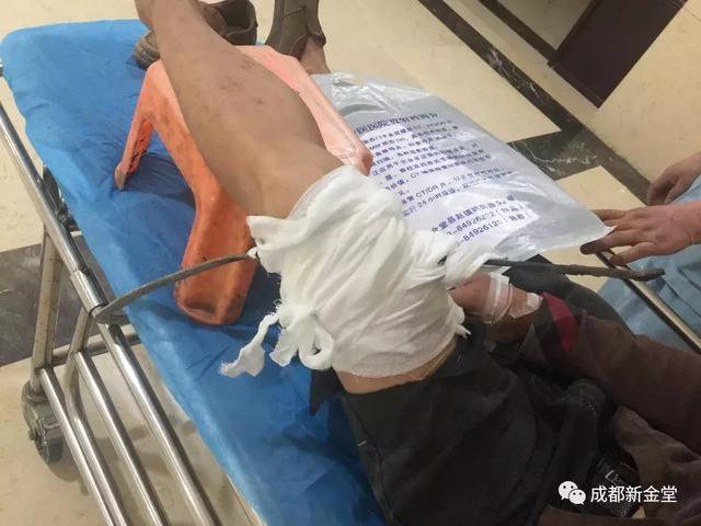 惊险80公分钢筋刺穿男子身体消防医生合力救他一命