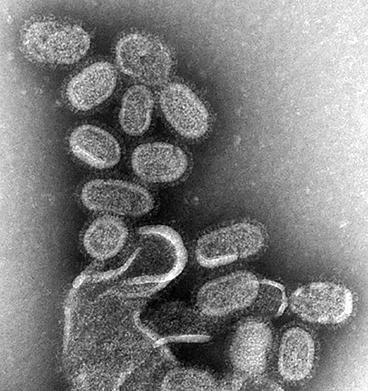 流感病毒電子顯微鏡照片 圖片來源:cdc5月20日 聖猶達兒童研究醫院的