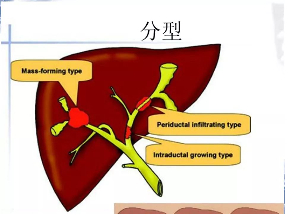 细菌性肝脓肿的影像诊断影像天地