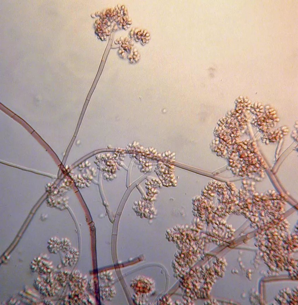 灰霉病菌孢子图片图片