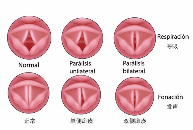 声带什么样子的图片图片