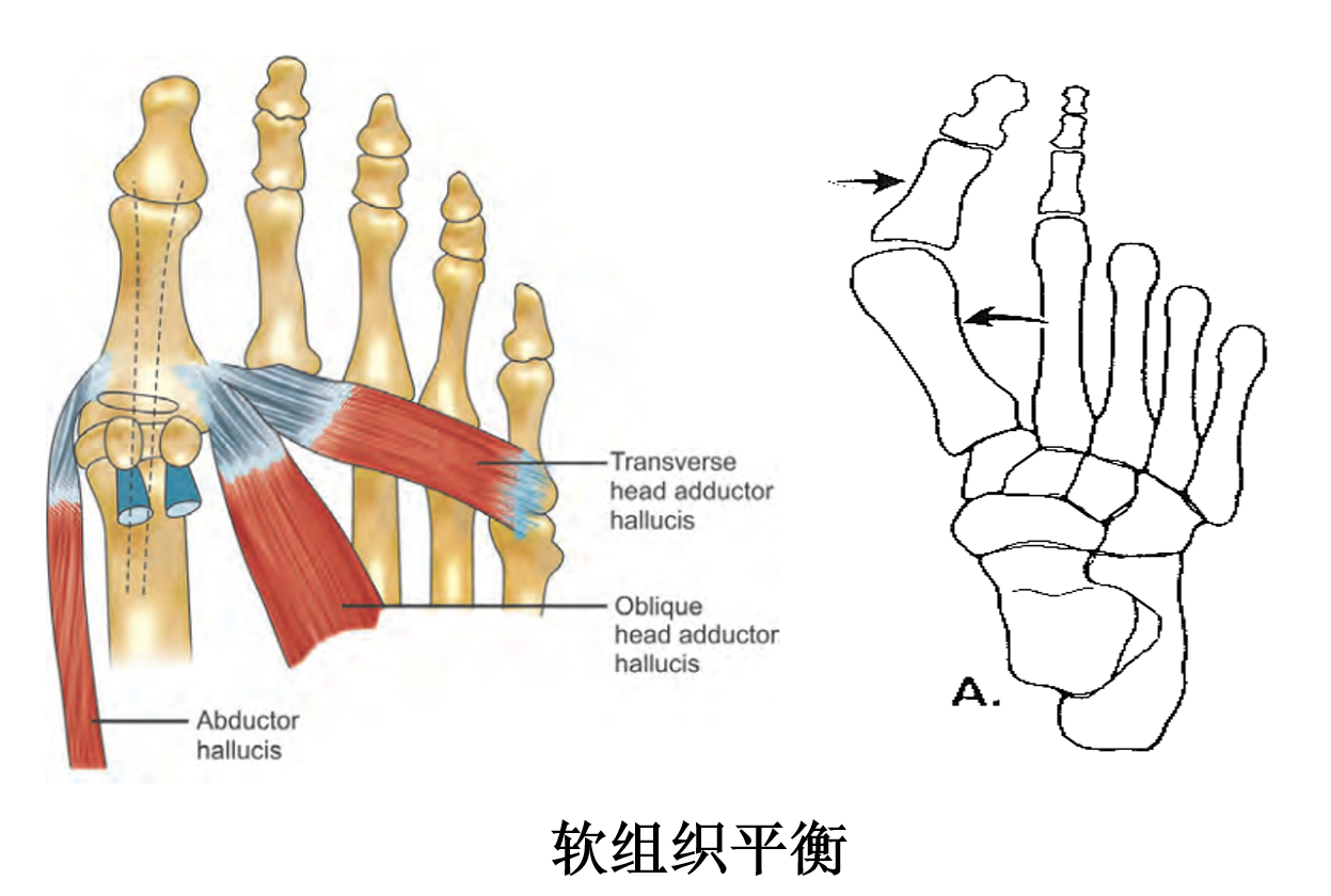 拇展肌起止点图片