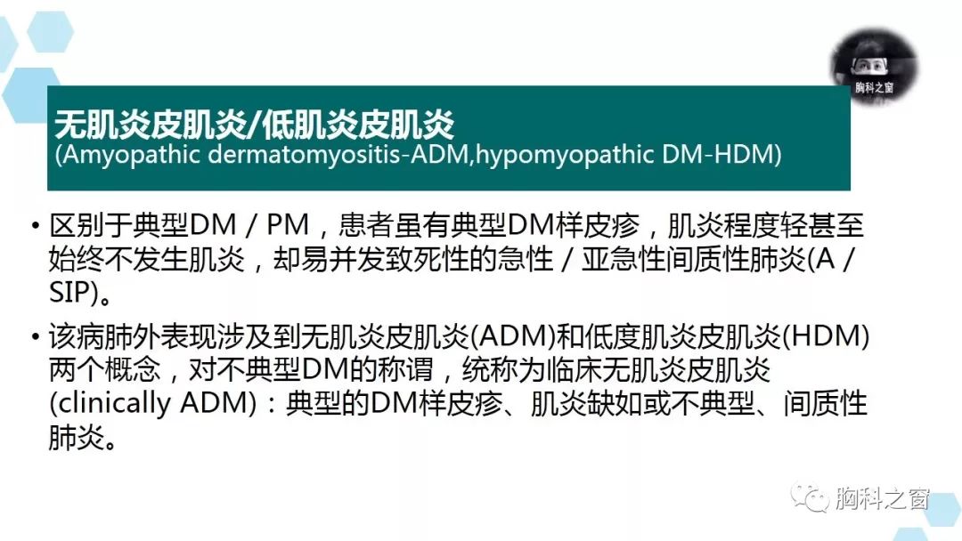 皮肌炎的自身抗体里,10-20%的肌炎患者可以检测到 mda5,而且mda5阳性