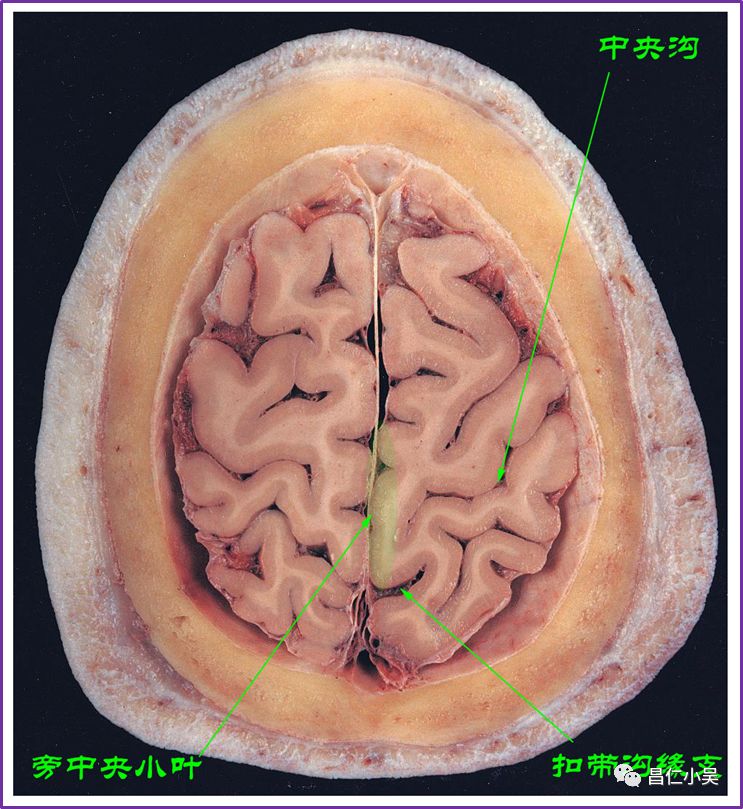 神經解剖學習筆記腦回腦溝