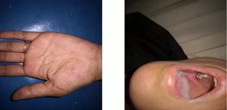 病例分享总是腹痛恶心呕吐都以为是消化病结果