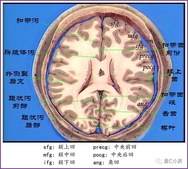 神经解剖学习笔记:脑回、脑沟_中央