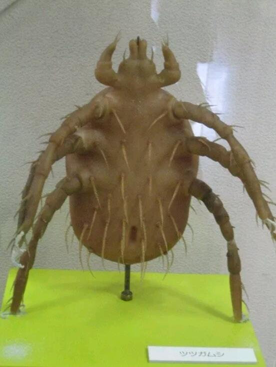 世界唯一的寄生虫博物馆体内长达八米的绦虫