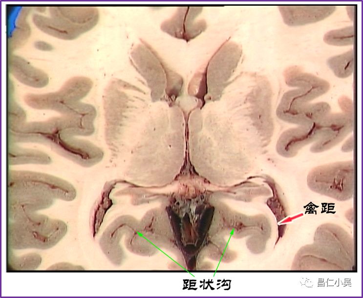 神經解剖學習筆記腦回腦溝