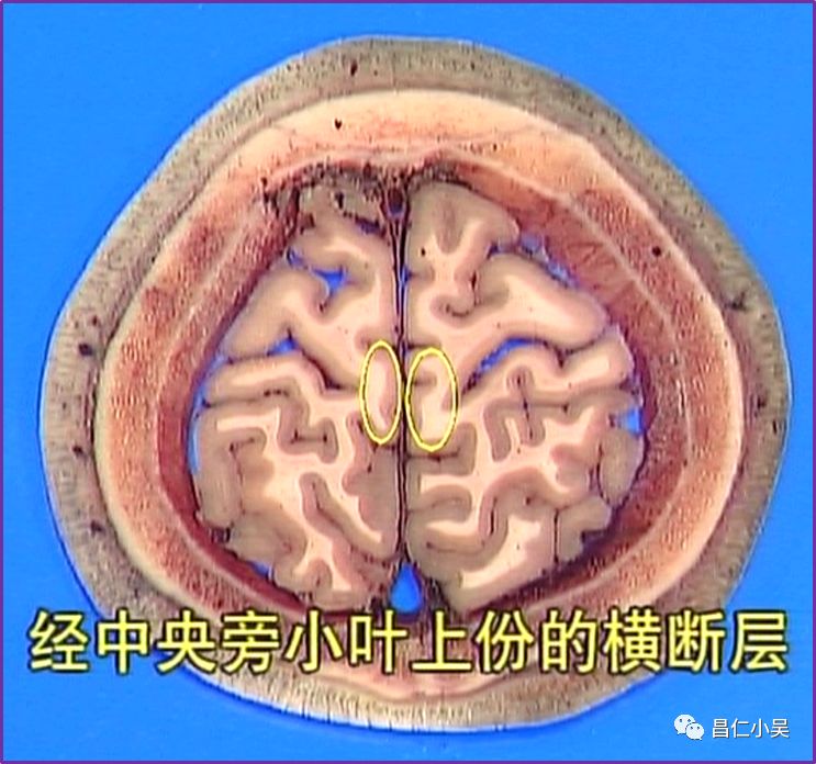 神经解剖学习笔记:脑回,脑沟_中央