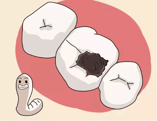 标题儿童蛀牙都有免费口腔检查了这三点告诉你公益不只是说说而已