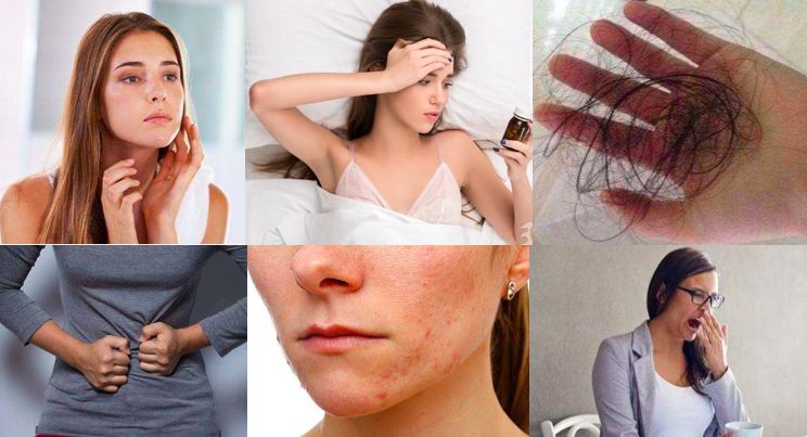 脑雾记不住事便秘脸油腻得不行爆痘疯狂掉头发熬夜肥荷尔蒙失调