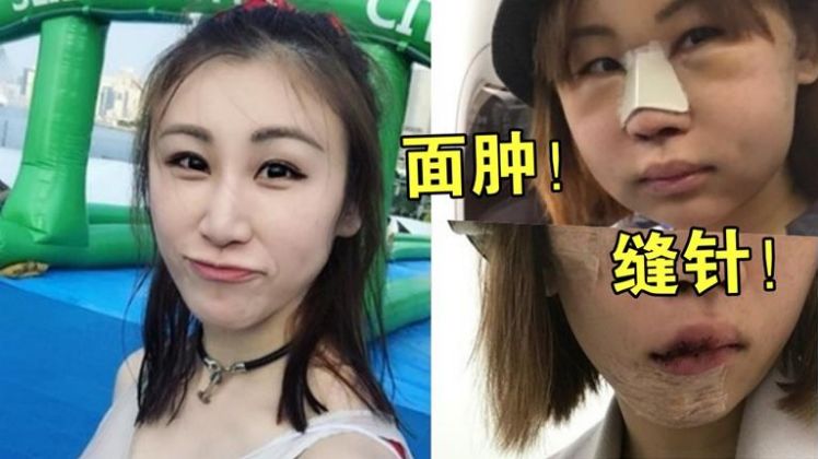 香港最倒霉女歌手意外毁容被x骚扰如今又自爆遭家暴