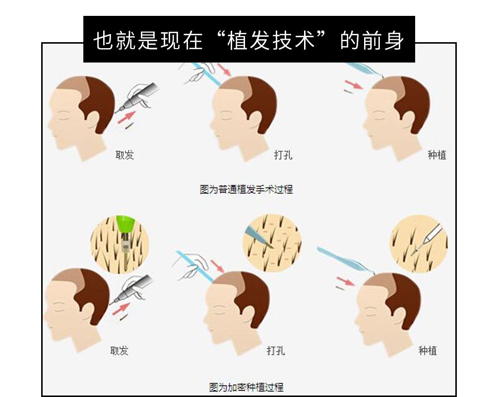 同样都是毛为啥待遇差别这么大