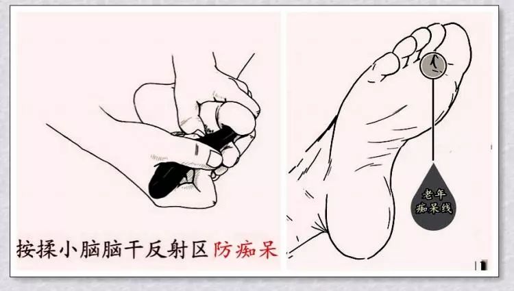 老年痴呆很可怕预防原来这么简单可惜99的人不知道附视频