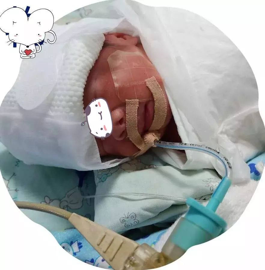 临泉县人民医院新生儿科成功开展新生儿picc置管新技术