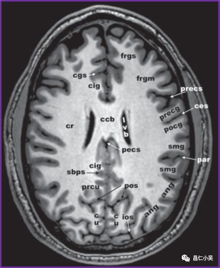 神经解剖学习笔记:脑回,脑沟