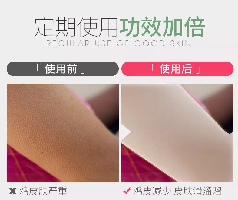 产后腿长鸡皮肤去除(产后大腿上鸡皮肤的原因)