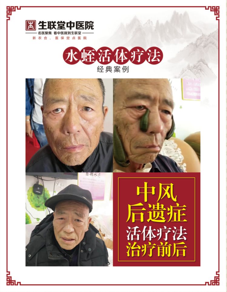 菲牛蛭在广西俗称金边蚂蝗,是广西特色的药物动物资源.