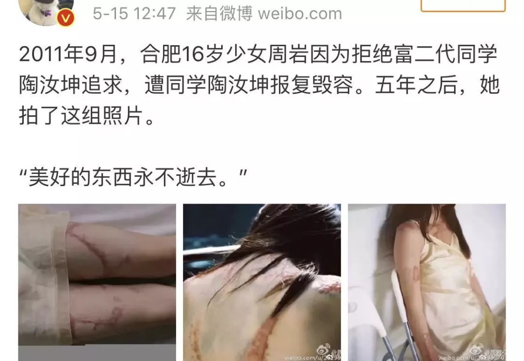 东京街头一牛郎被捅数刀杀人女魔被捕时面露笑容因为我太喜欢他了