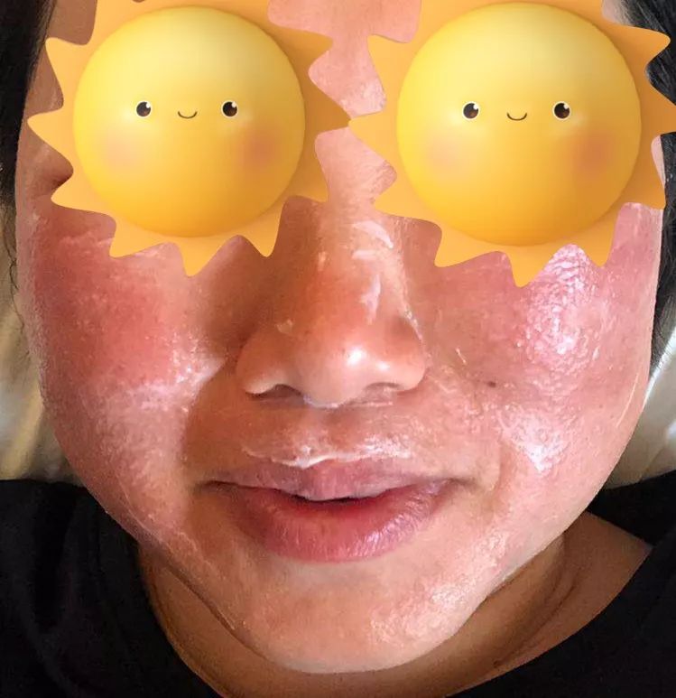 可炒菜还可卸妆深圳一位小姐姐用食用椰子油洗脸结果