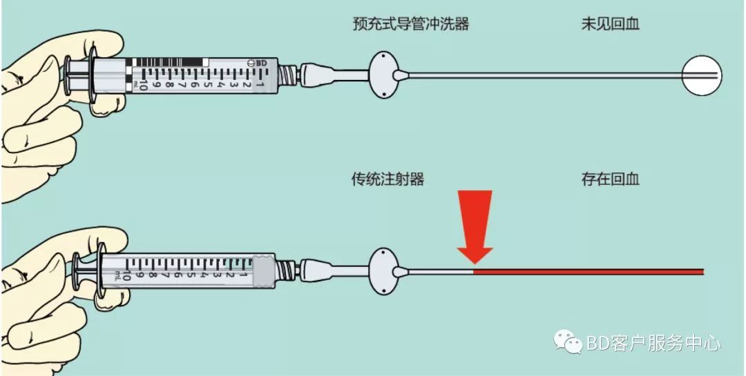 唾液腺导管堵塞图片图片