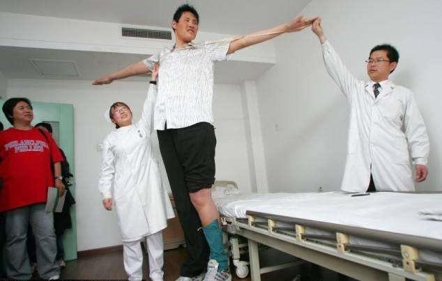 然而在经过医院检查之后,确定赵亮的身体是正常的,他没患上巨人症