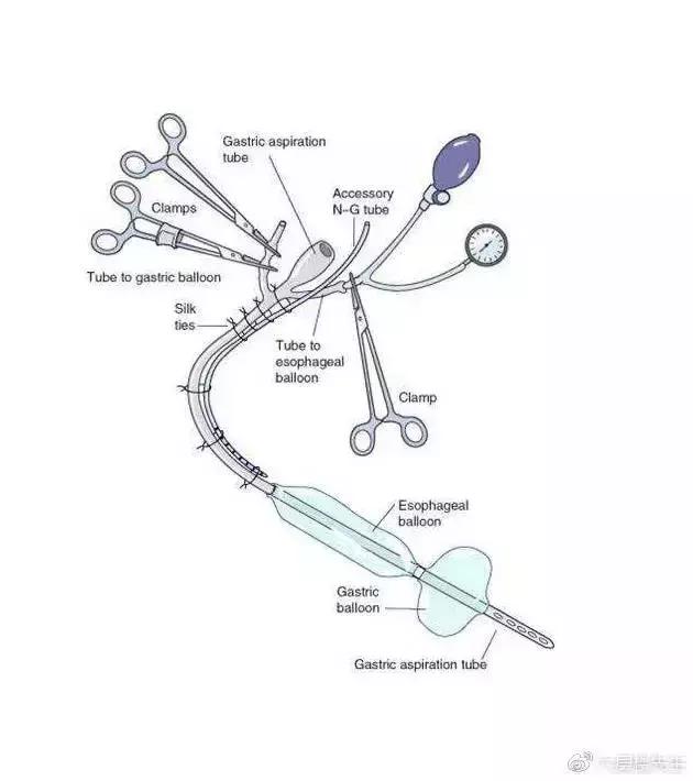 灯泡塞进肛门怎么拿出来?