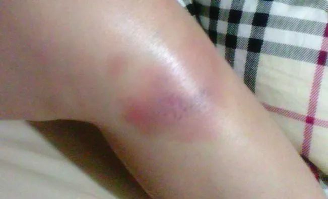 蚊虫叮咬,跌打损伤,头晕脑胀