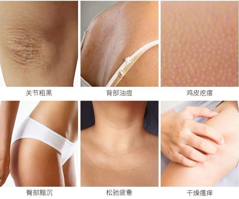 女生怎样保养鸡皮肤好看(女生怎样保养鸡皮肤好看呢)