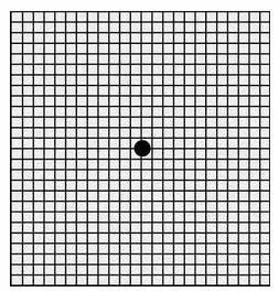 这是一张阿姆斯勒方格表,可用于黄斑变性自查