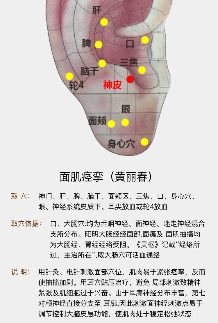 清华大学玉泉医院推荐:颅神经疾病中西医结合一体化治疗方案(面肌痉挛