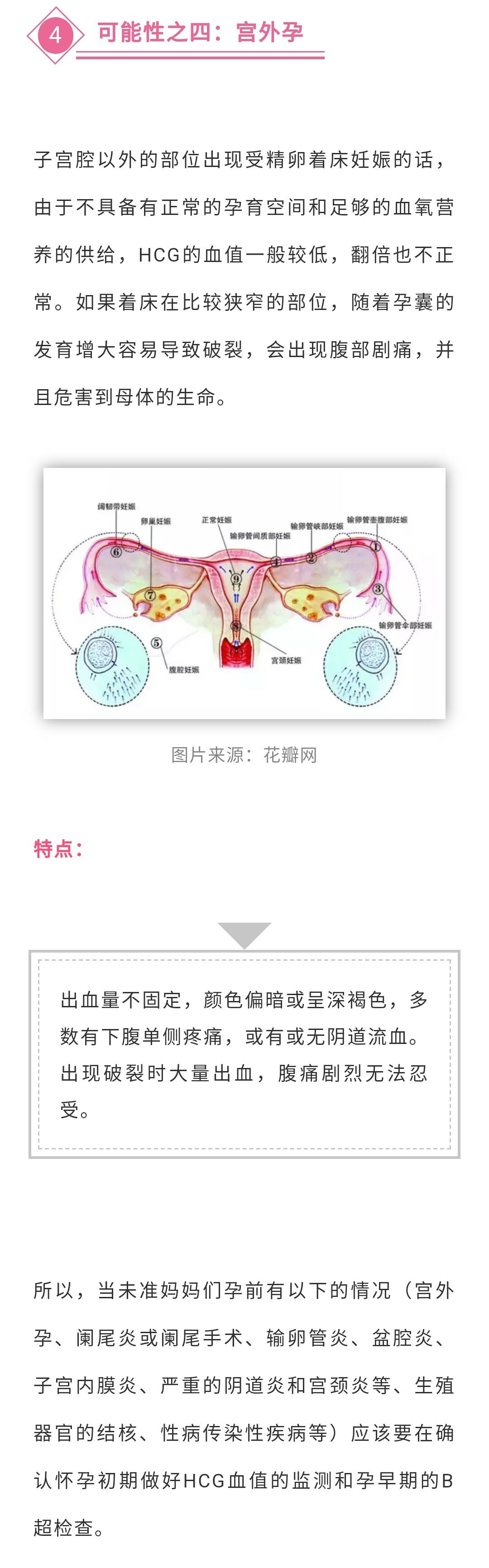 孕早期出血流产可能还有这8个原因